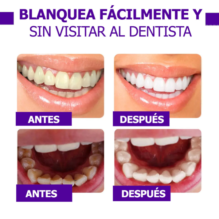 V34™ | SÉRUM BLANQUEADOR DENTAL