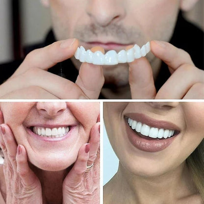 SMILEFLEX™ | CARILLAS DENTALES DE CERÁMICA